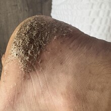 Cody Taylor - Sentier International des Appalaches-Québec GR A1 (QC, Canada)