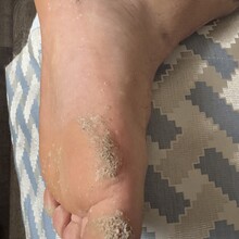 Cody Taylor - Sentier International des Appalaches-Québec GR A1 (QC, Canada)