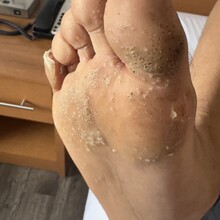 Cody Taylor - Sentier International des Appalaches-Québec GR A1 (QC, Canada)