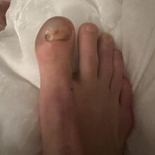 Candice Burt - Pine Creek Pentangle (CO)