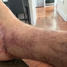 Craig Millikin - Ozark Highlands Trail (AR)